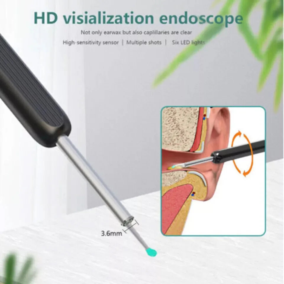 Ear Wax Removal with Camera (Otoscope)